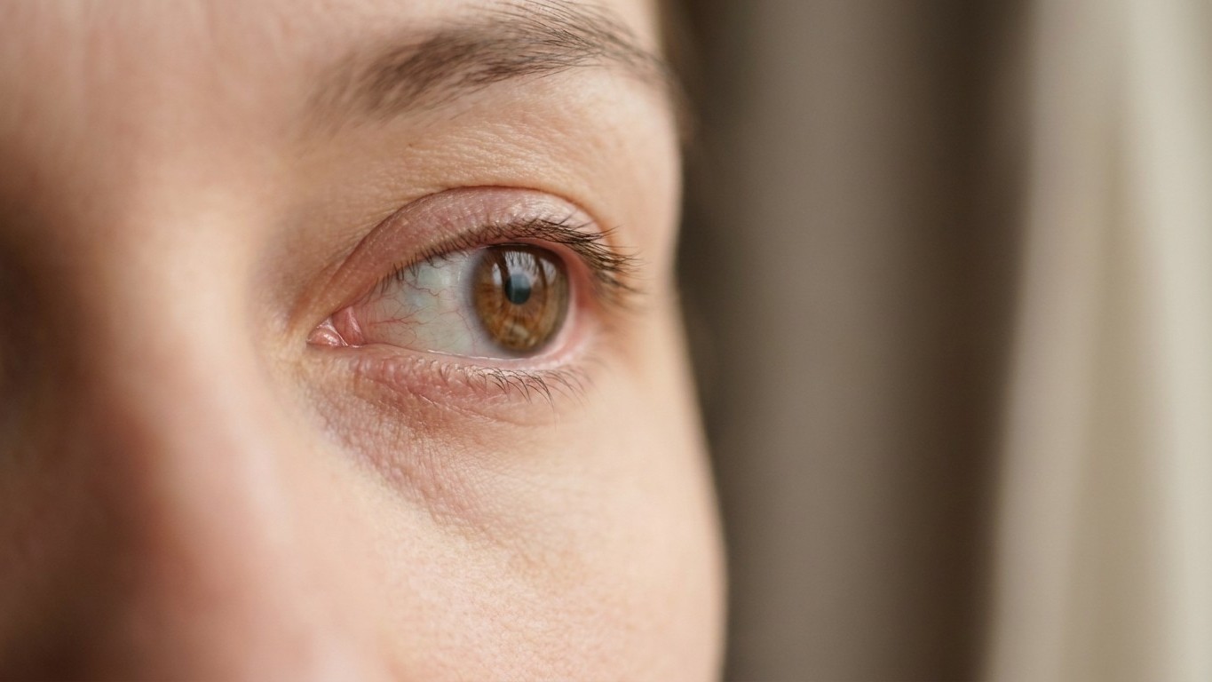 Vos lentilles ne craignent rien pendant la sieste ? Un ophtalmologue montre ce que la cornée subit dès que la paupière se ...